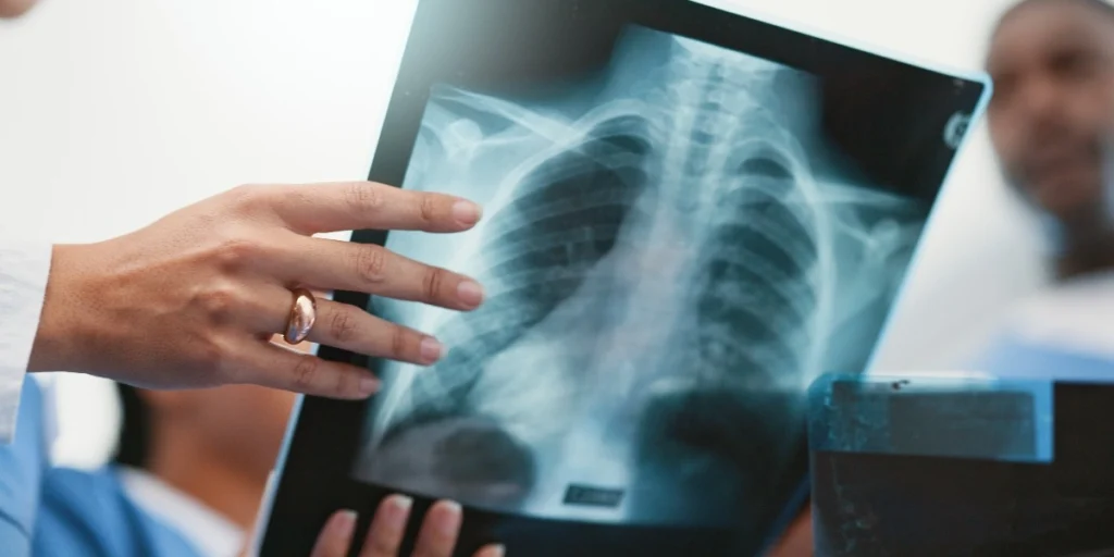 X Ray